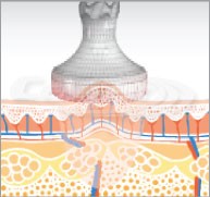 eunsung-lipozero-vacuum